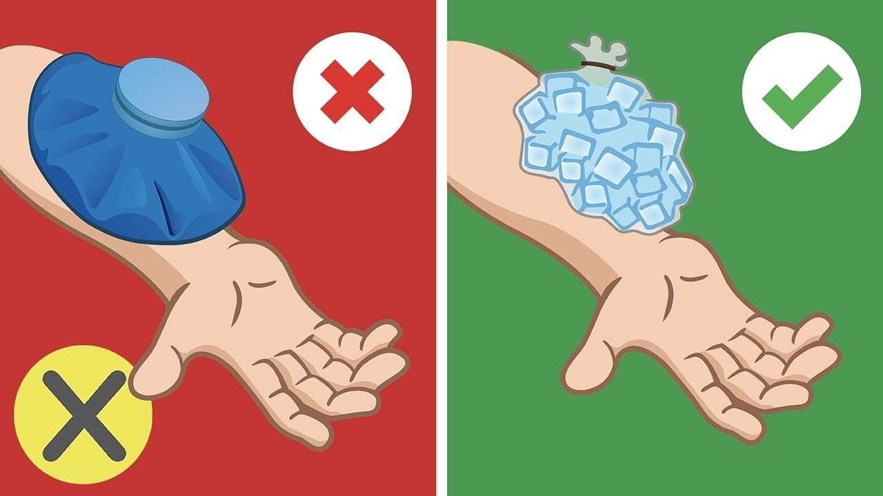10 curiosidades sobre primeros auxilios que debes saber