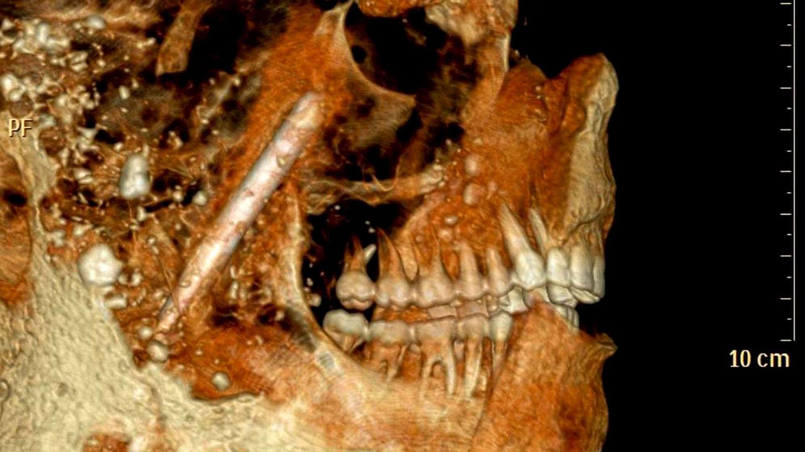 Curiosidades antiguas reveladas por los dientes